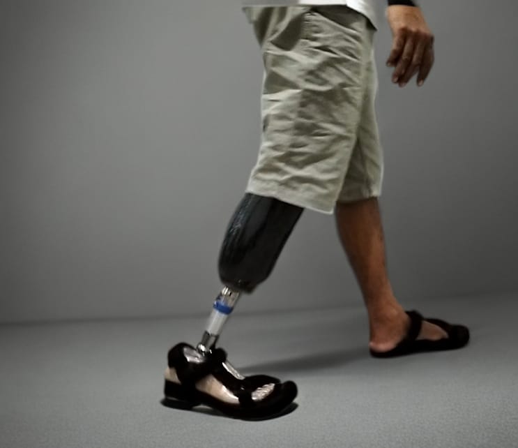 Below Knee Prosthesis