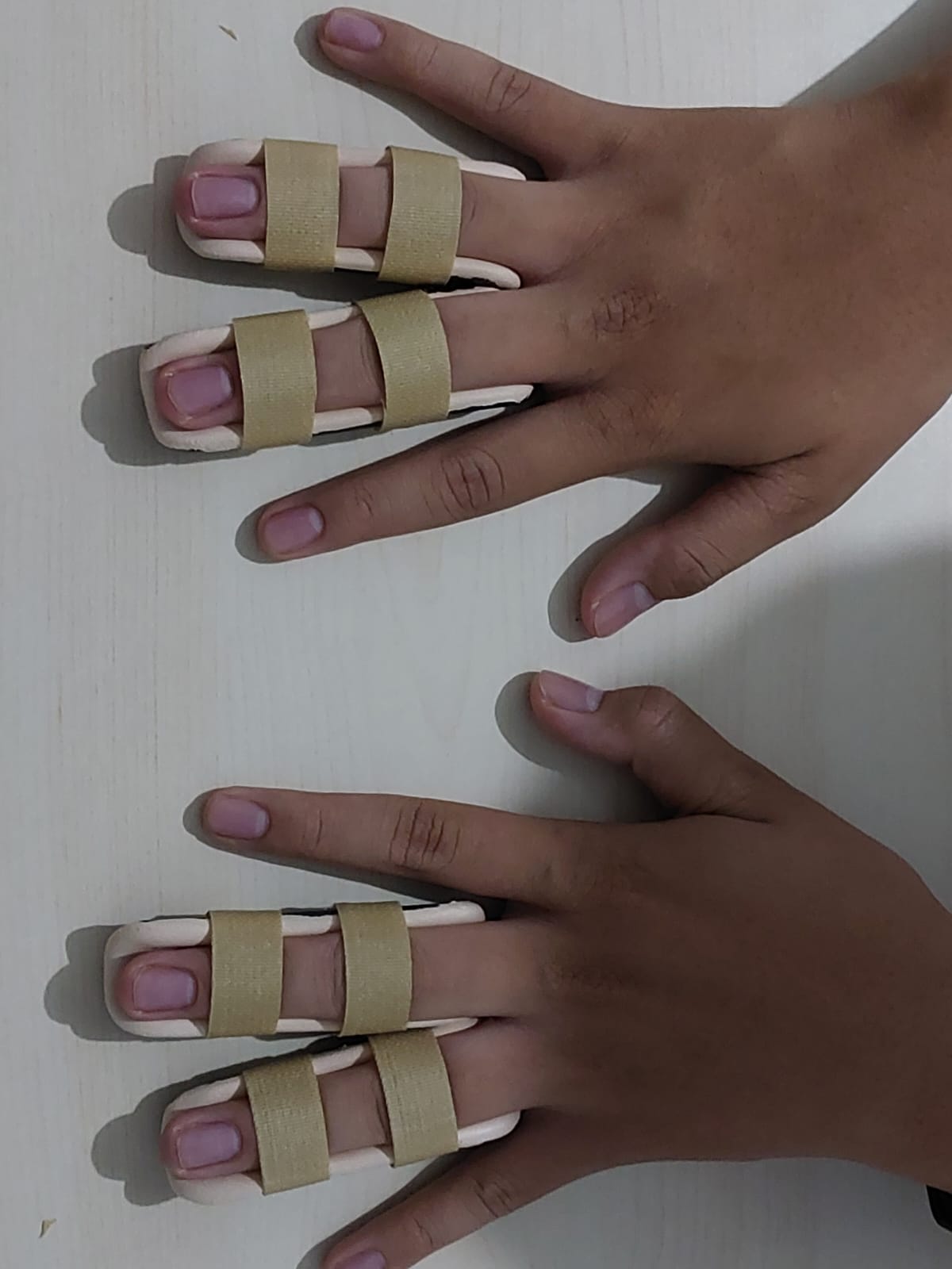 Finger Splint 1