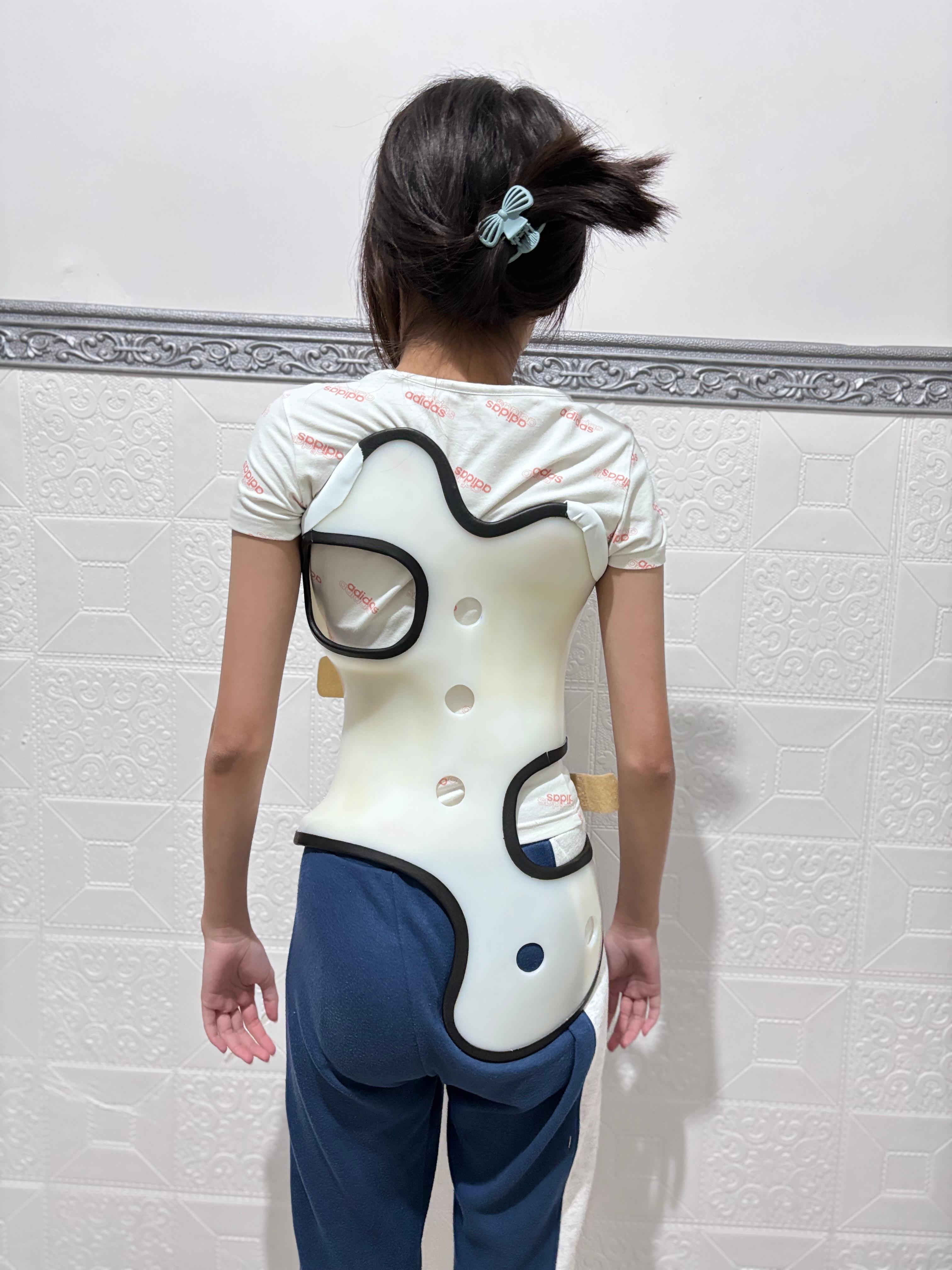 Scoliosis Brace