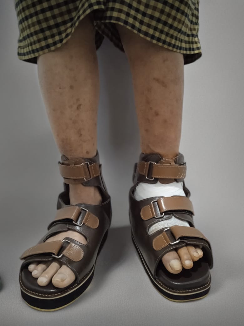 Sandal Diabetic 1